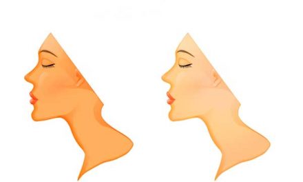 5 dicas de como clarear a pele