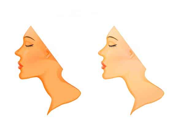 dicas de como clarear a pele